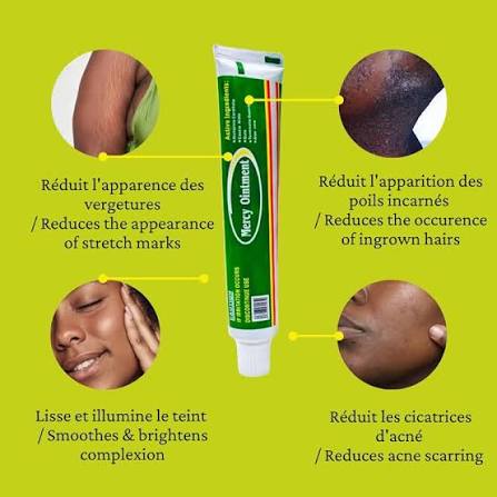 Mercy Ointment – Pommade Miracle Contre Acné, Taches Noires, Rougeurs, Vergetures et Impuretés de la Peau